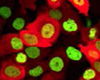 蛍光タンパク質発現がん細胞