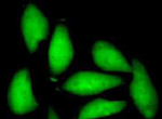 蛍光タンパク質遺伝子 (GFPおよび RFP）の導入画像01