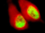 蛍光タンパク質遺伝子 (GFPおよび RFP）の導入画像02