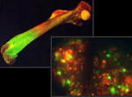マウスメラノーマの骨転移のイメージング、二色イメージングによる繊維肉腫の肺転移